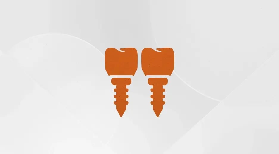 implants-card-test-2